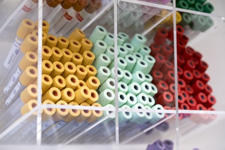 vials for blood draws and lab testing.jpg